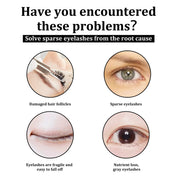 Eelhoe Castor Oil Eyelash and Eyebrow Serum