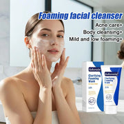 10% Benzoyl Peroxide Foaming Wash, 85 g
