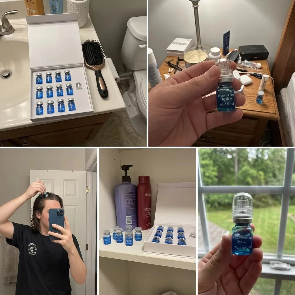 Microneedle Scalp Care Kit with Nourishing Serum