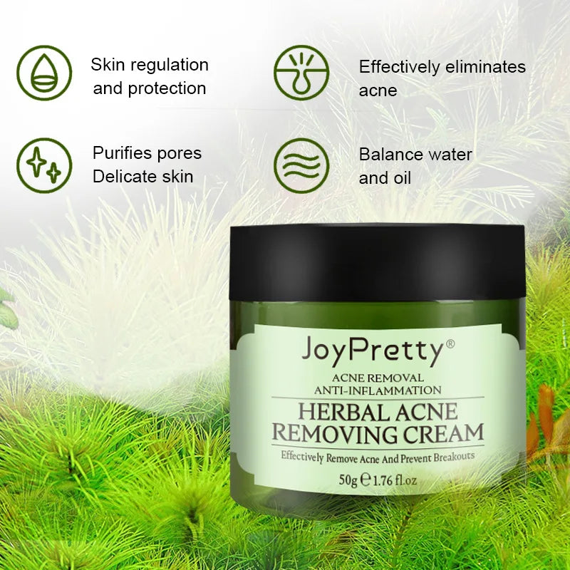 JoyPretty Herbal Anti-Acne Face Cream, 50g