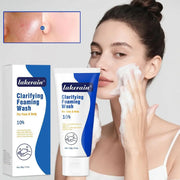 10% Benzoyl Peroxide Foaming Wash, 85 g