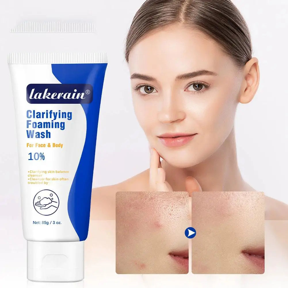 10% Benzoyl Peroxide Foaming Wash, 85 g