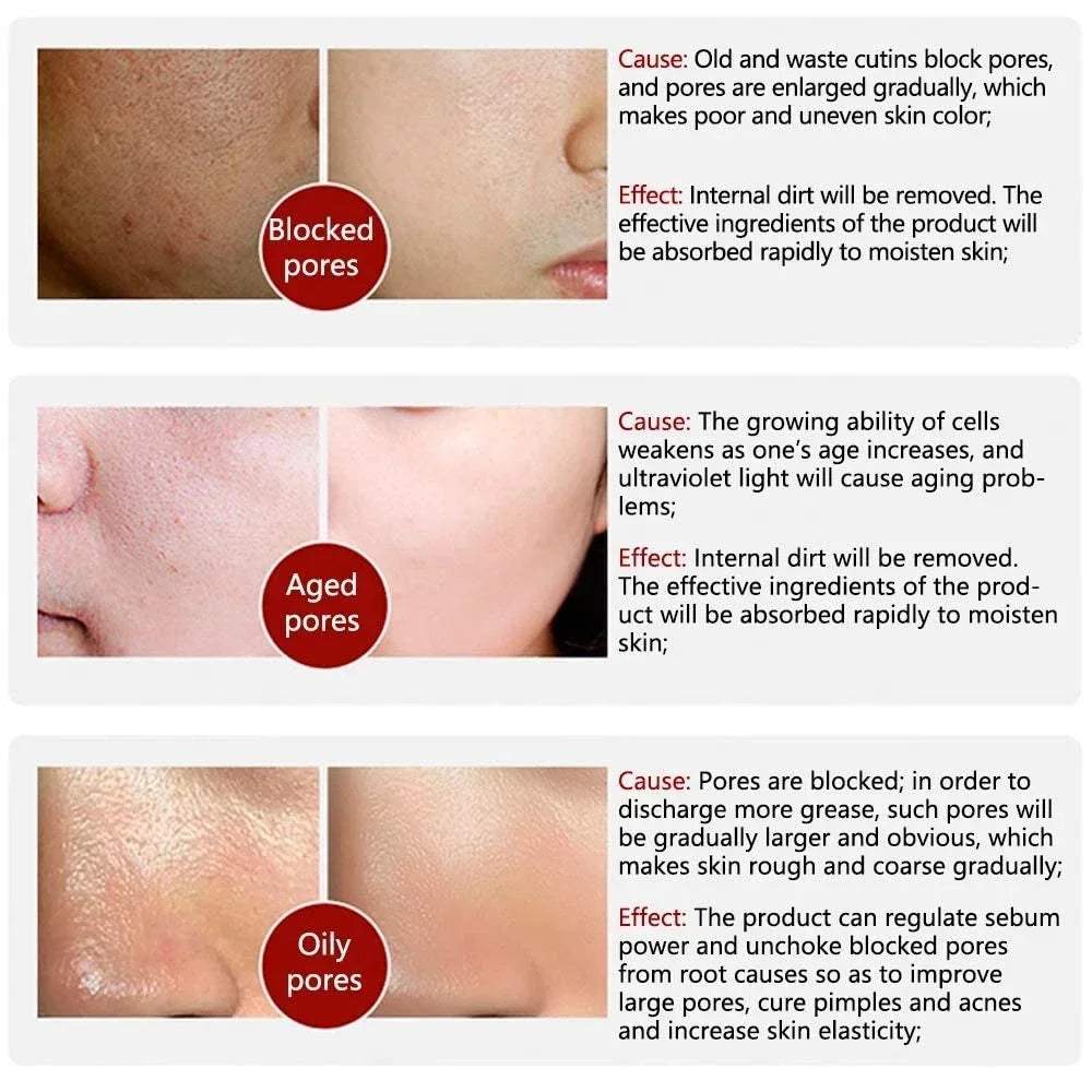 Retinol and Niacinamide Facial Serum