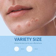 Hydrocolloid Pimple Patches