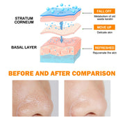 Enzyme Exfoliating Gel with Salicylic Acid