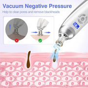 Windaily Wireless Diamond Microdermabrasion Machine