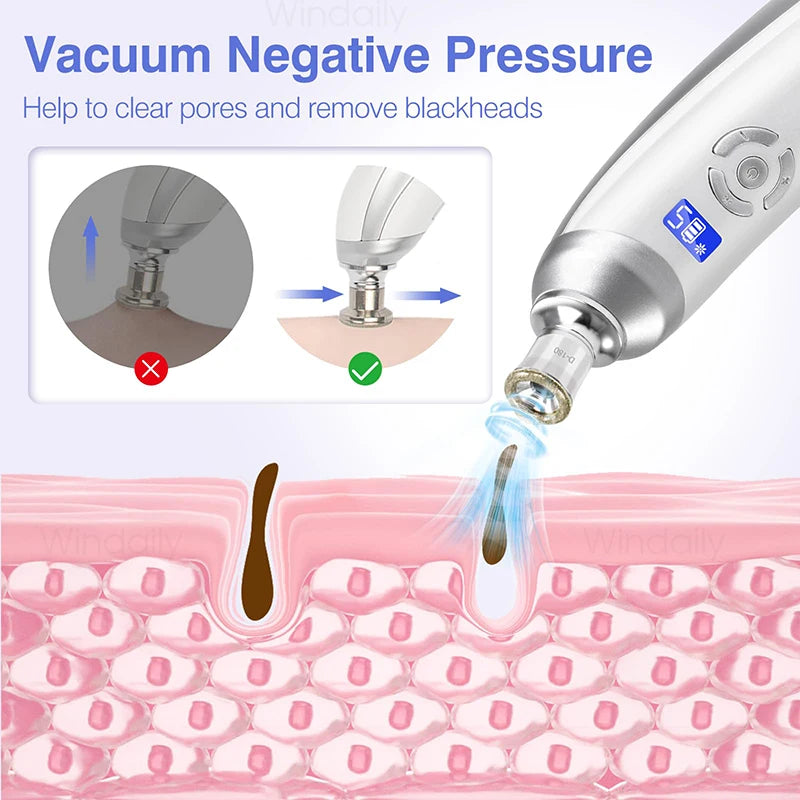 Windaily Wireless Diamond Microdermabrasion Machine