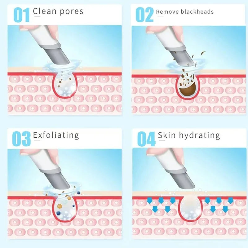 Vilnason Hydra Dermabrasion and Oxygen Facial Machine
