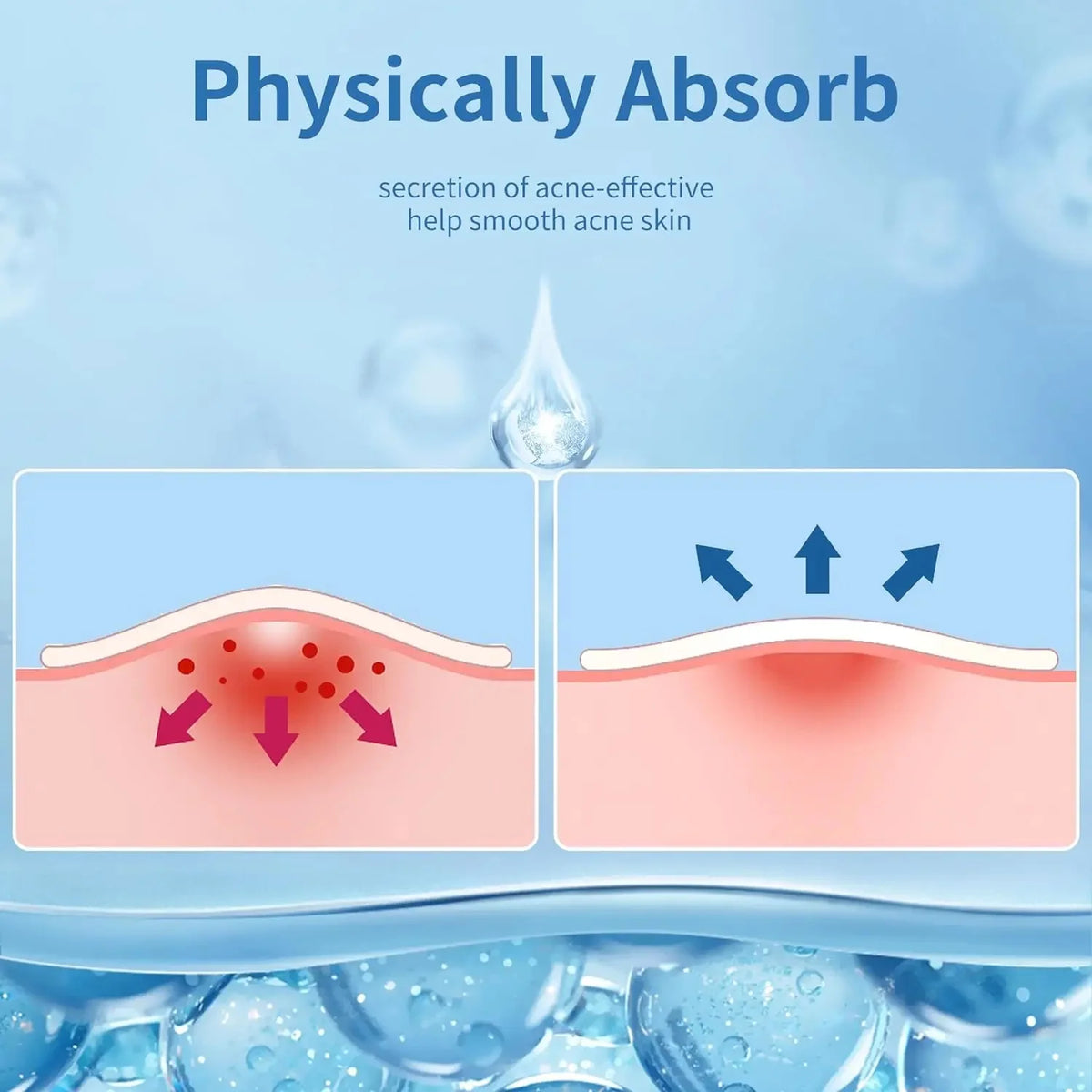 Invisible Hydrocolloid Acne Patches, 180 to 400 Pieces