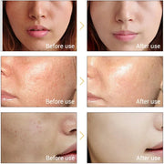 KEMOKO Ultrasonic and Ionic Facial Cleaner