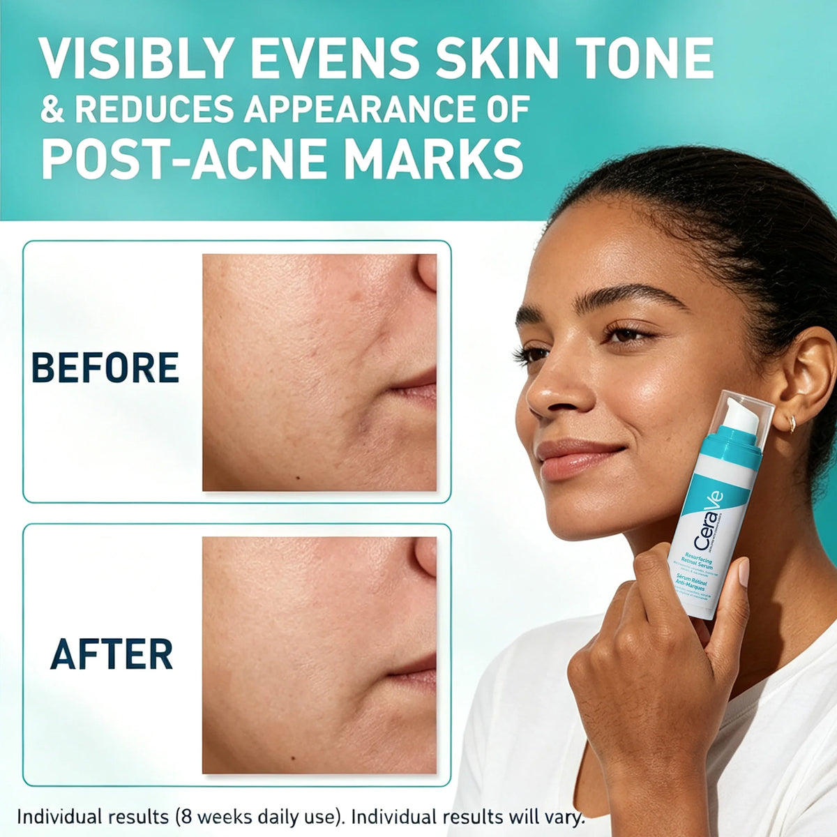 CeraVe Retinol Serum with Niacinamide and Licorice Root