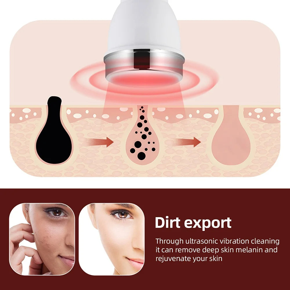 Foreverlily Ultrasonic Facial Beauty Device