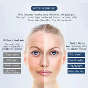 KEMOKO Ultrasonic and Ionic Facial Cleaner