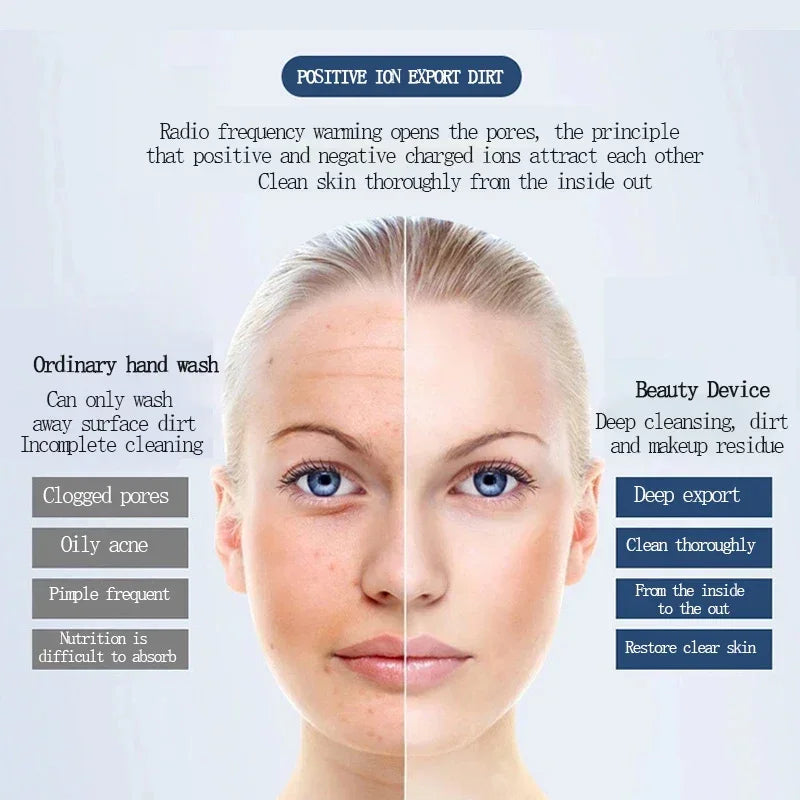 KEMOKO Ultrasonic and Ionic Facial Cleaner