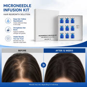 Microneedle Scalp Care Kit with Nourishing Serum