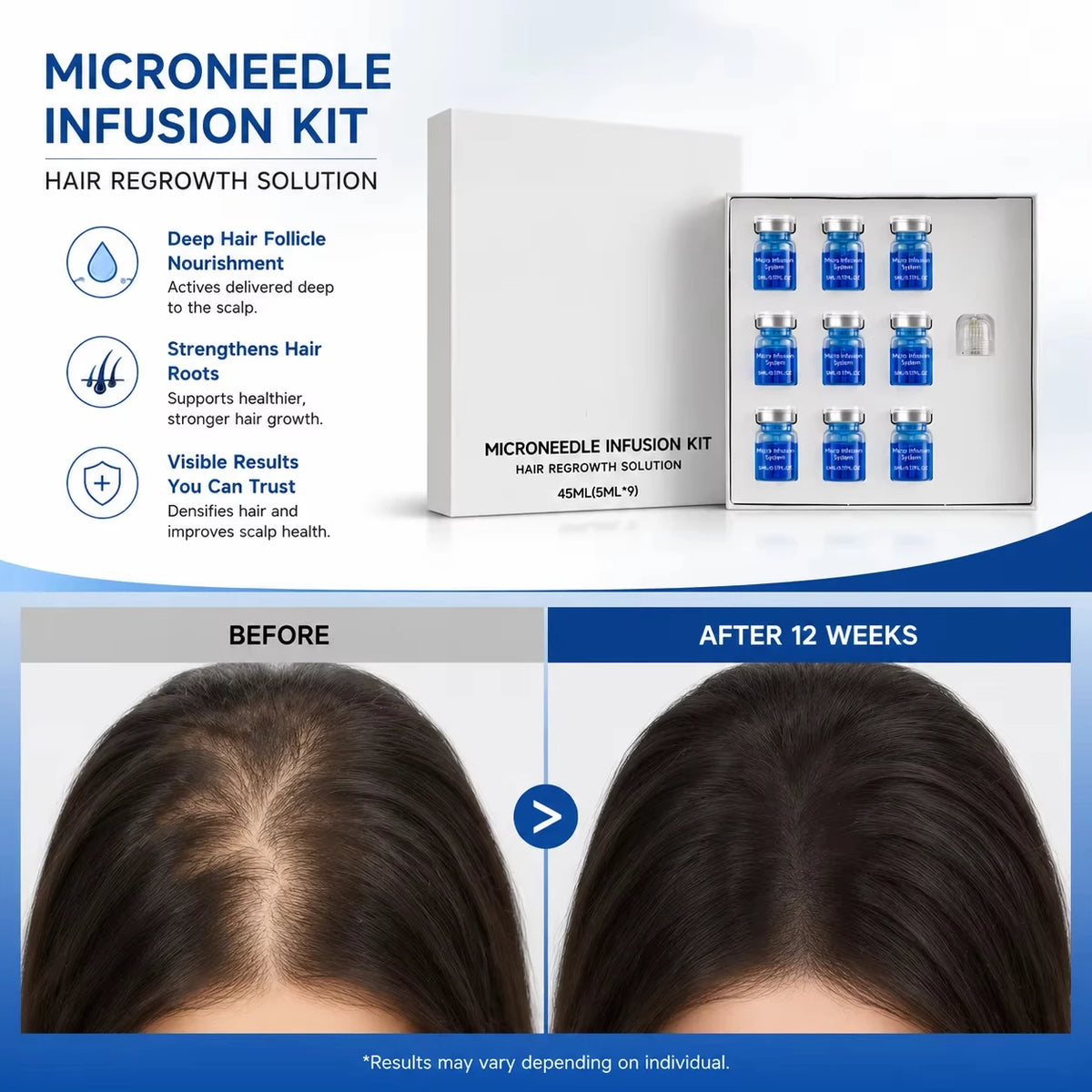 Microneedle Scalp Care Kit with Nourishing Serum
