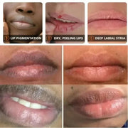 Lip Care Balm and Mask