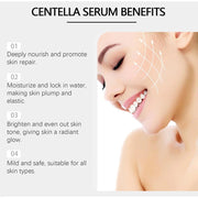 Centella Asiatica Microneedle Essence, 50g
