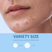 Invisible Hydrocolloid Acne Patches, 180 to 400 Pieces
