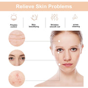 Windaily High-Frequency Facial Wand with Neon and Argon Tubes