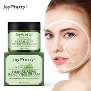 JoyPretty Herbal Anti-Acne Face Cream, 50g
