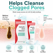 Salicylic Acid Foaming Facial Cleanser, 150 g