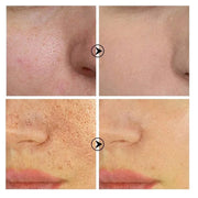 Retinol and Niacinamide Facial Serum