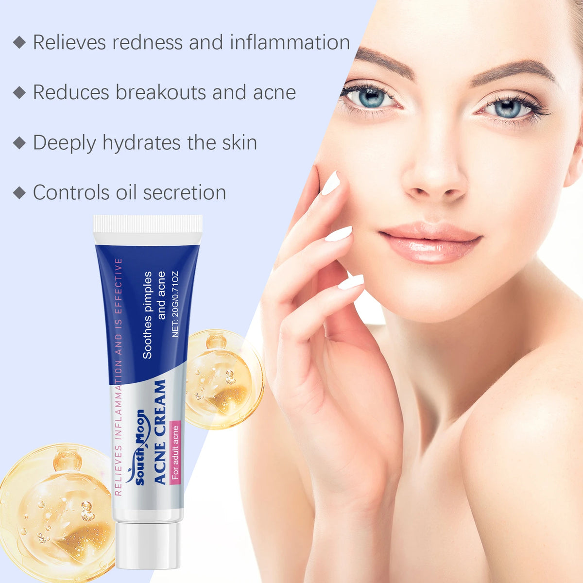 South Moon Anti-Acne Cream, 20g