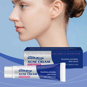 South Moon Anti-Acne Cream, 20g