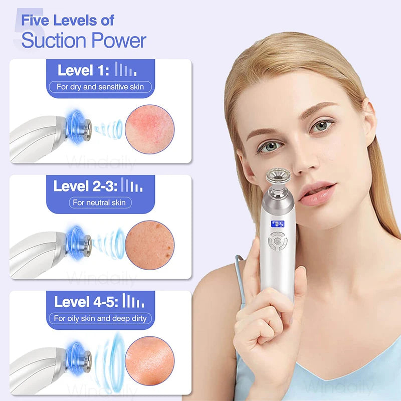 Windaily Wireless Diamond Microdermabrasion Machine