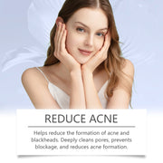 South Moon Anti-Acne Cream, 20g
