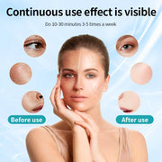 7-Color LED Face and Neck Mask
