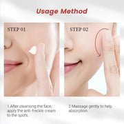 Niacinamide Dark Spot and Freckle Cream, 20 g