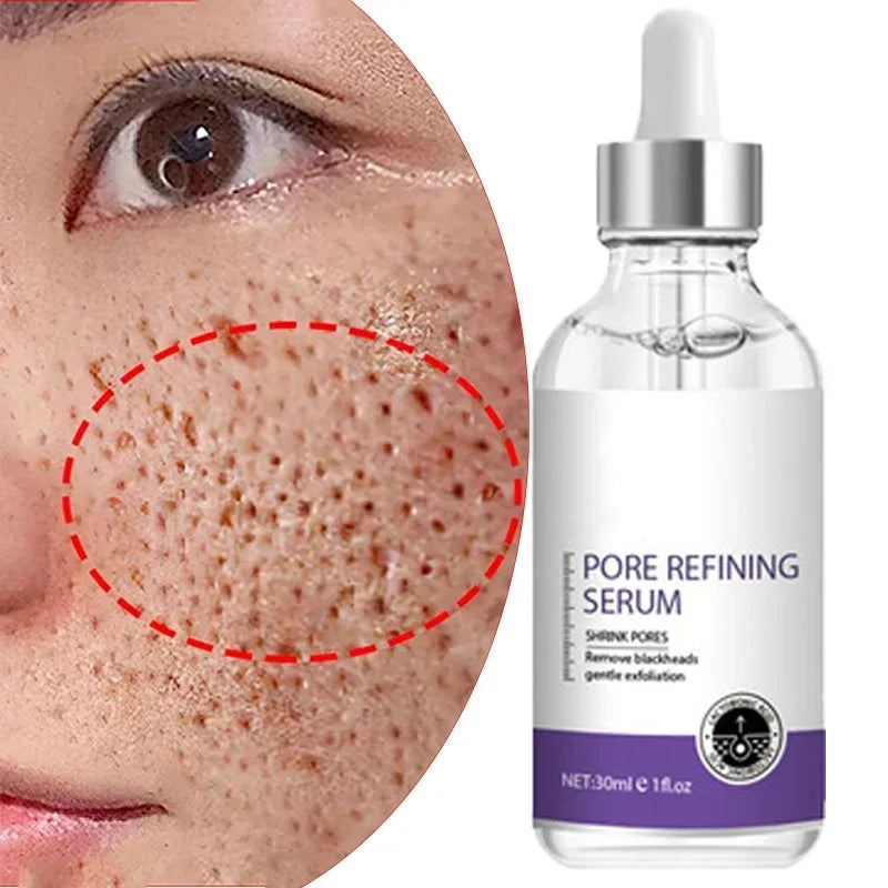 Retinol and Niacinamide Facial Serum