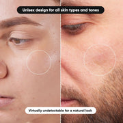 Hydrocolloid Pimple Patches