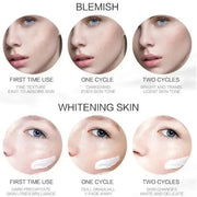 Niacinamide Dark Spot and Freckle Cream, 20 g