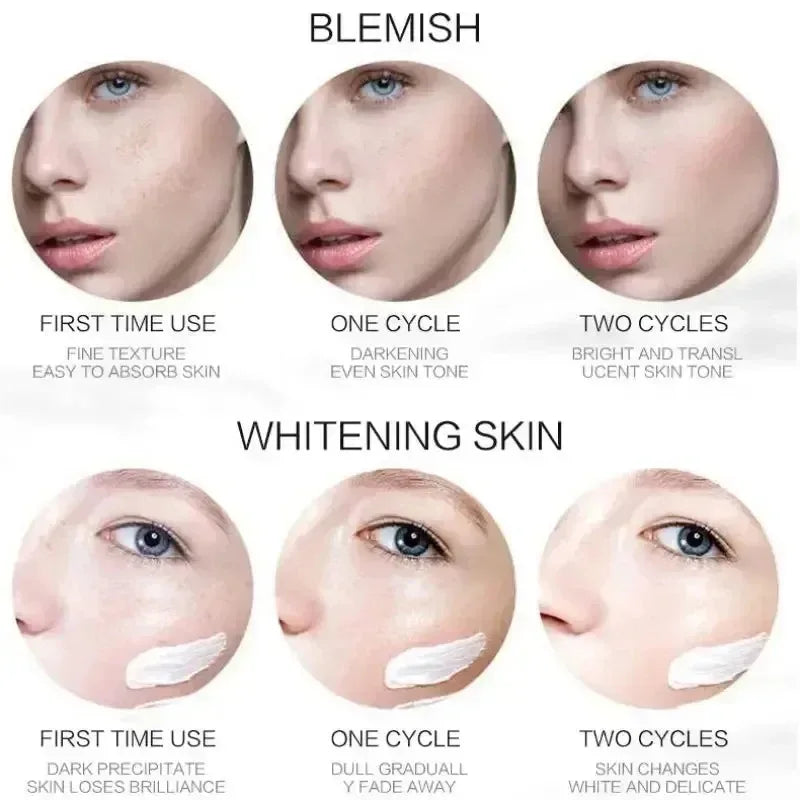 Niacinamide Dark Spot and Freckle Cream, 20 g