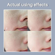 Retinol and Niacinamide Facial Serum