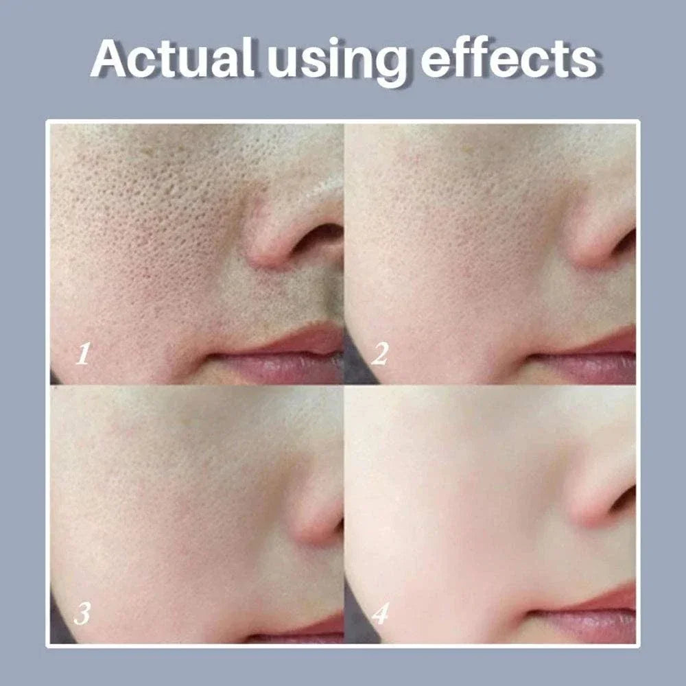 Retinol and Niacinamide Facial Serum